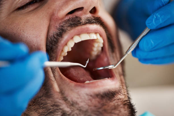 Best Broken or Cracked Tooth Emergency Dentist in Tawas City, MI